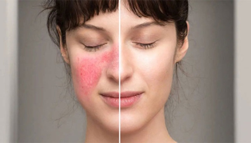 Lupus ban do he thong co the bieu hieu o hau het moi co quan Fujiiryoki Official - Website Fujiiryoki chính thức tại Việt Nam